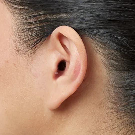 Invisible-In-The-Canal hearing aid shown in ear